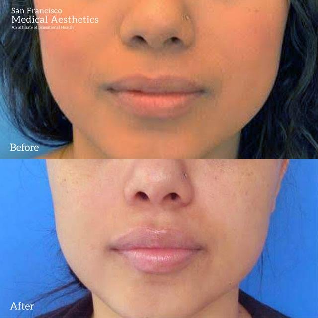 San Francisco Medical Aesthetics - Med Spa in San Francisco, CA