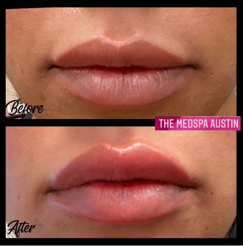 The Medspa Austin