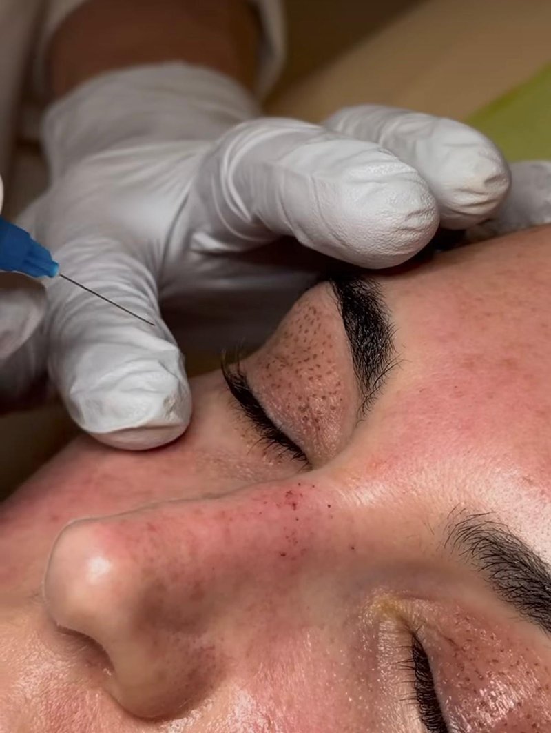 Zeugma MedSpa - Med Spa in Miami, FL